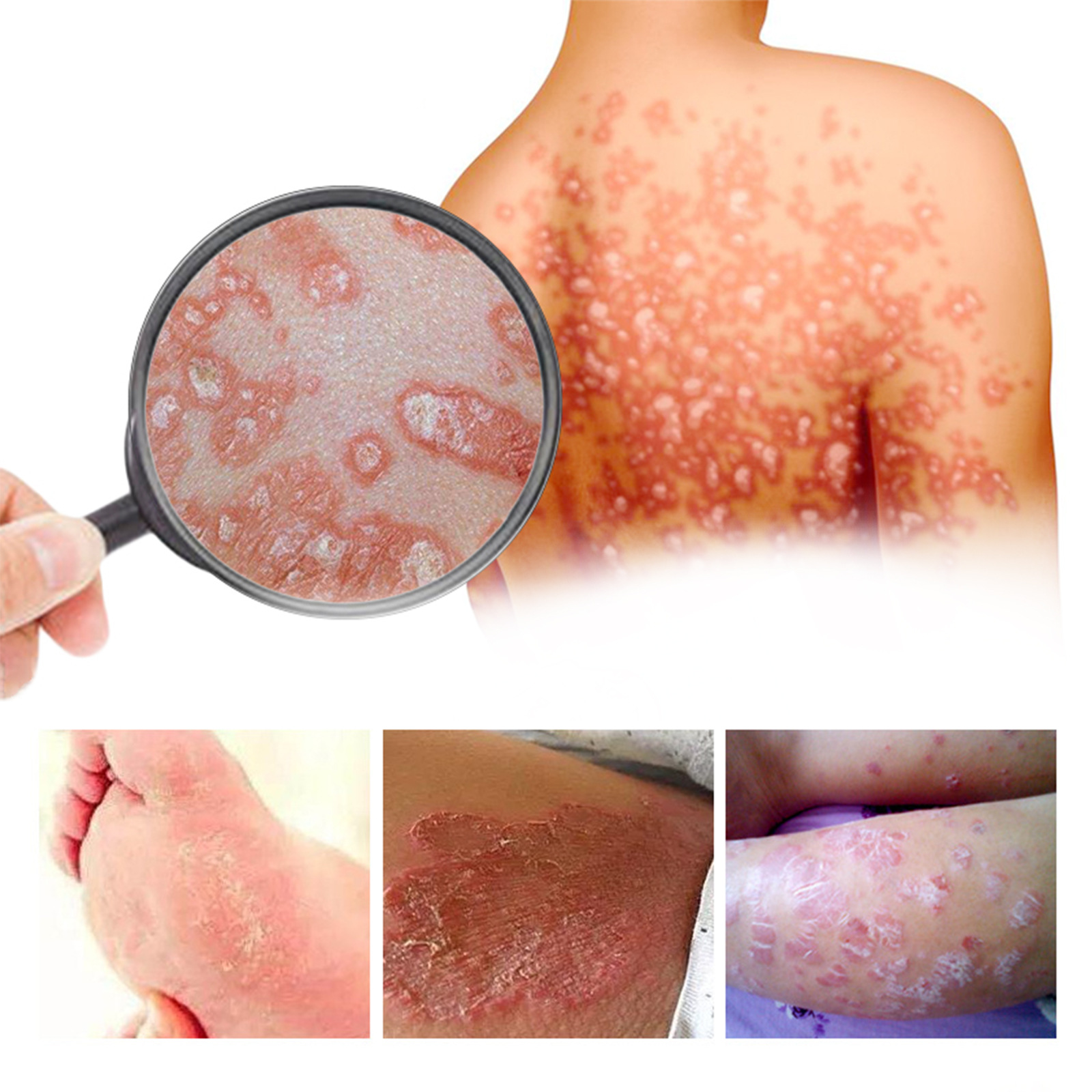 South Moon Skin Repair Cream relieves skin itching, repairs hand and foot, moisturizes skin and relieves itching care_voghion.com