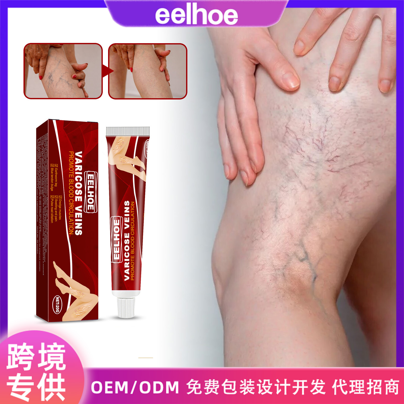 eelhoe vein massage varicose ointment re...