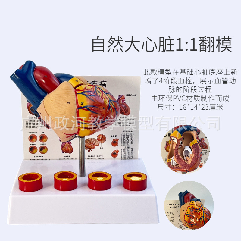 人体标准心脏解剖模型 B超彩超可拆卸自然大心脏医学教学教具模型|undefined
