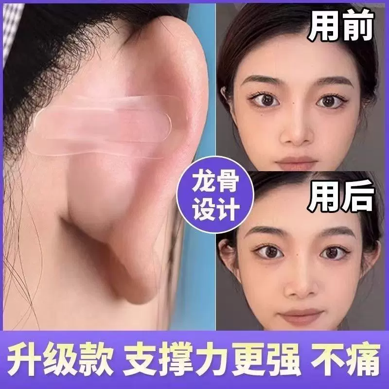 南通优玖精灵耳贴招风耳固定贴强支撑贴面耳矫正贴隐形拍照显脸小