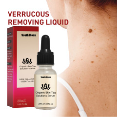 South Moon Mole Elimination Liquid, deep cleansing skin, wart reduction, black mole repair, smoothing skin care liquid
