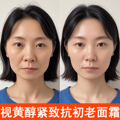 レチノール シワ改善 シワ改善 エッセンスクリーム 保湿 引き締め メンテナンス 水分補給 保湿 小じわ改善 くすみ改善クリーム