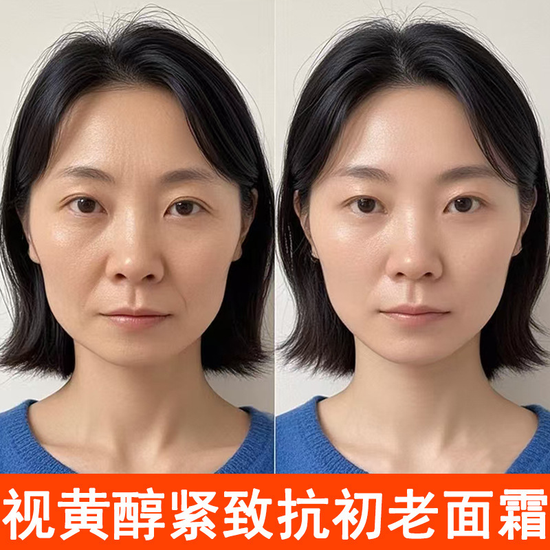 レチノール シワ改善 シワ改善 エッセンスクリーム 保湿 引き締め メンテナンス 水分補給 保湿 小じわ改善 くすみ改善クリーム|undefined