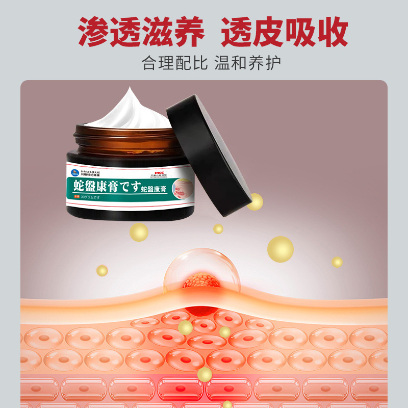 Serpiente placa cuidado de la salud crema cintura-bobinado dragón de fuego serpiente cintura-bobinado piel burbuja picazón ungüento anti-picazón crema fabricante en stock Venta caliente