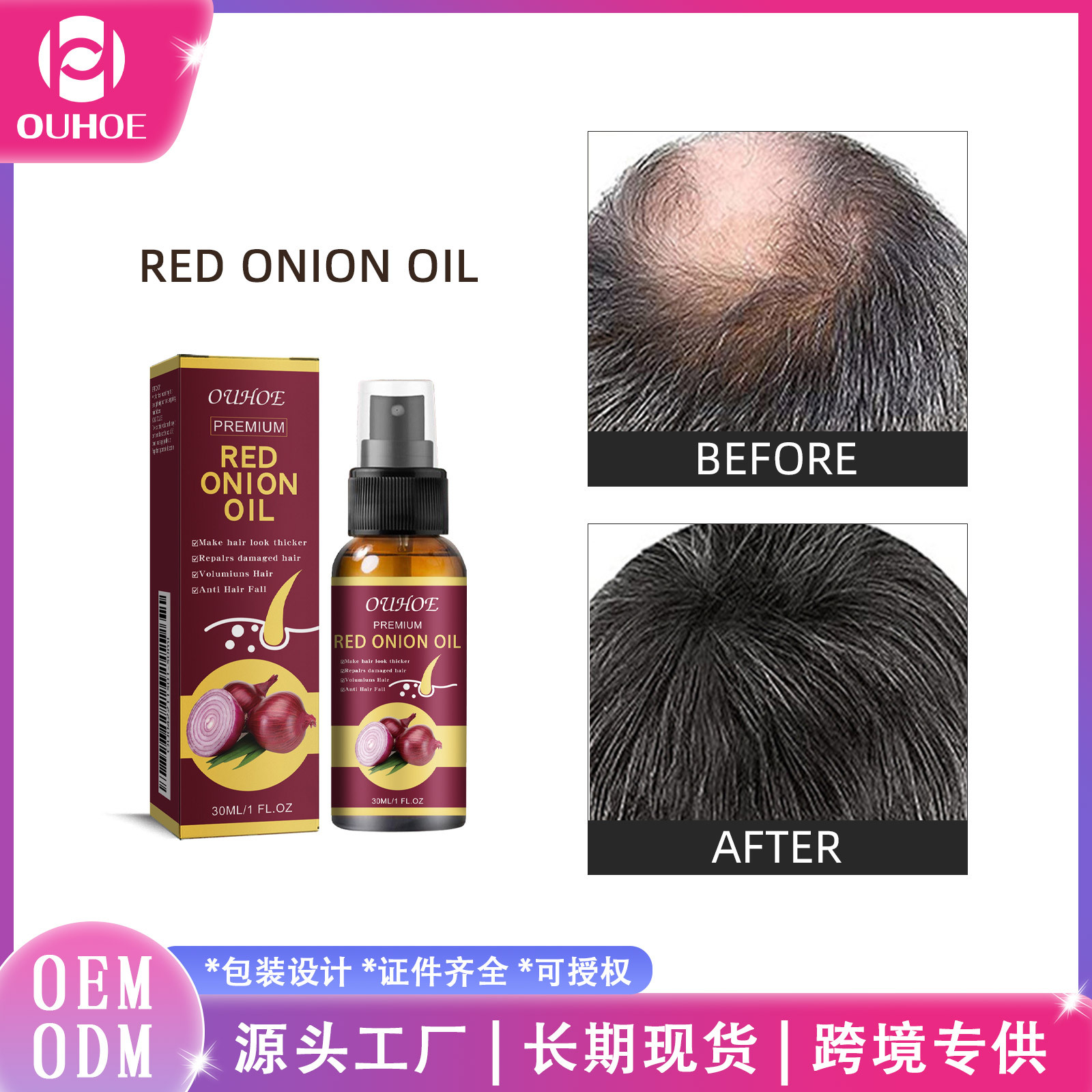 Aceite esencial para el cuidado del cabello de cebolla ouhoe cuidado del cabello suave, fuerte, hidratante e hidratante spray diario para el cuidado del cabello