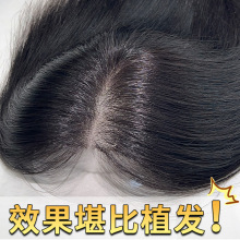 假发片女头顶增发量蓬松遮白发真人发隐形无痕刘海假发头顶补发片