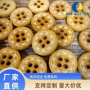 �����¿���Ȼ���|�����۸߶���߅ɭϵ�WԺ�Lë���_���r���~�����