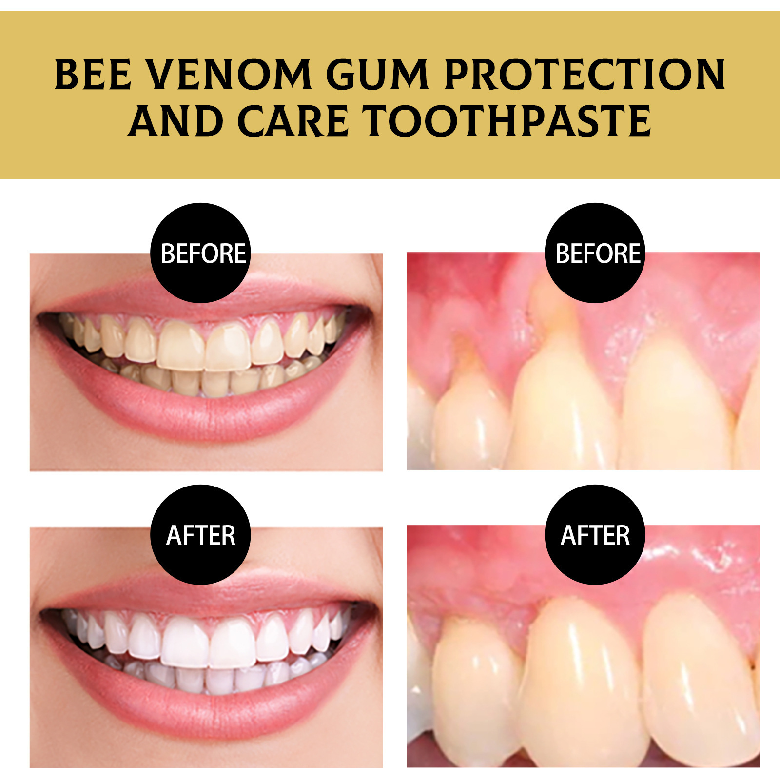EELHOE Bee Venom Gingival Protection for Deep Cleaning of Dental Stains, Oral Odors, Fresh Breath, Whitening T_voghion.com