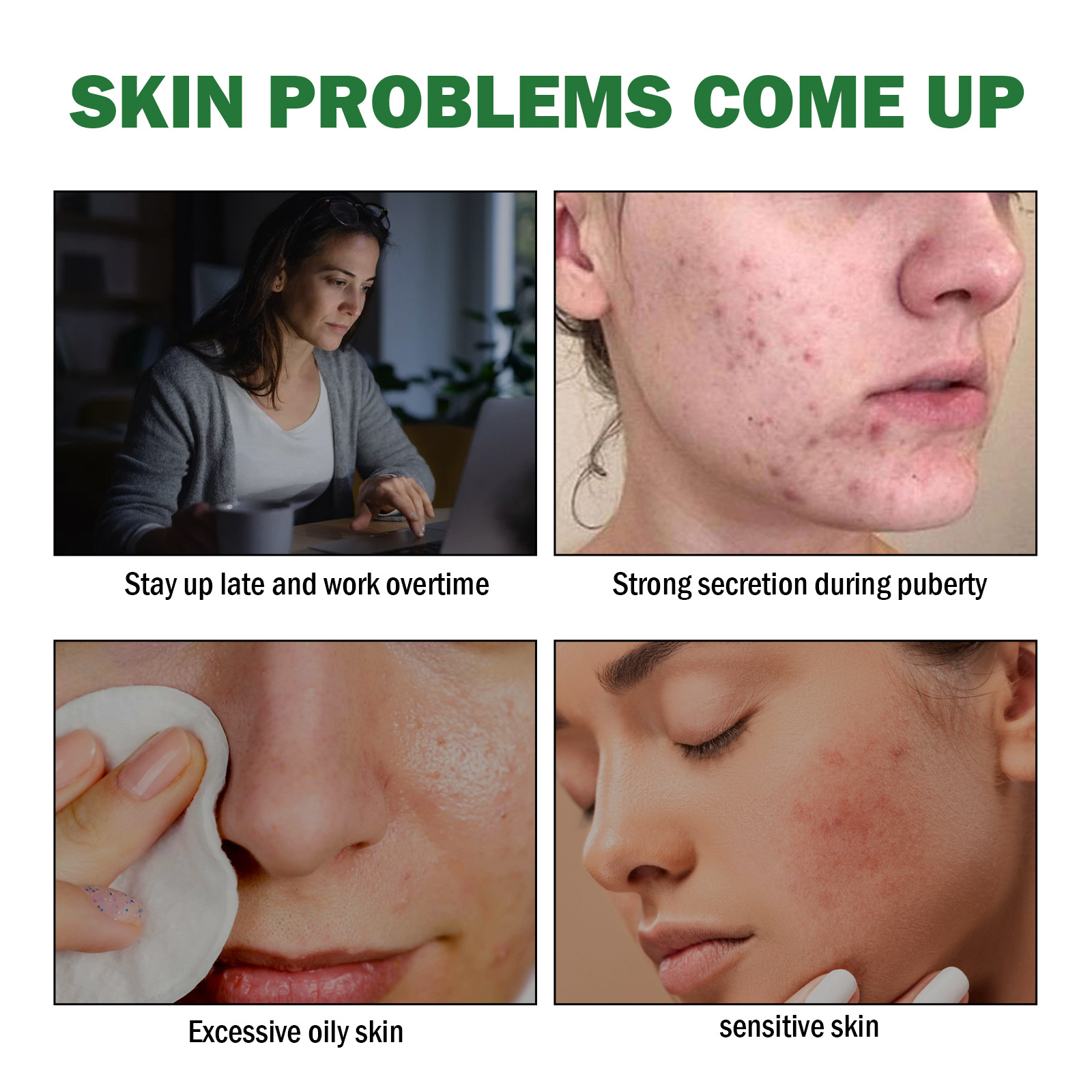 EELHOE Gel detergente all'aloe Schiarisce Chiude la bocca Acne, Migliora la pelle acneica, Idrata Cura della pelle_voghion.com