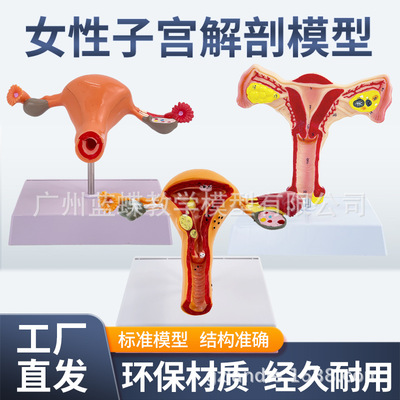 teaching simulation human body Uterus Ovary anatomy Model Female sex Reproduction anatomy Model Department of gynecology train Teaching aids