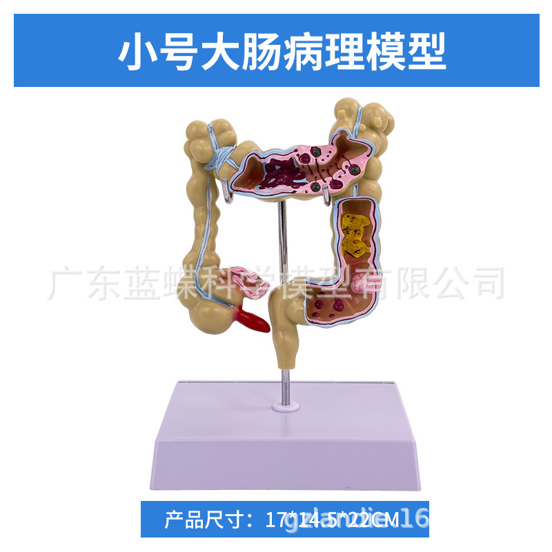 ��ѧ��������󳦲���ģ�ͳ�θֱ���̴�������ʳ��������᳦����