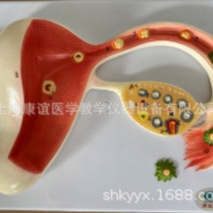 Kay-A584B Ovary and Uterus Relief Model Fertilized Egg Model Urinary Genitourinary Endocrine System
