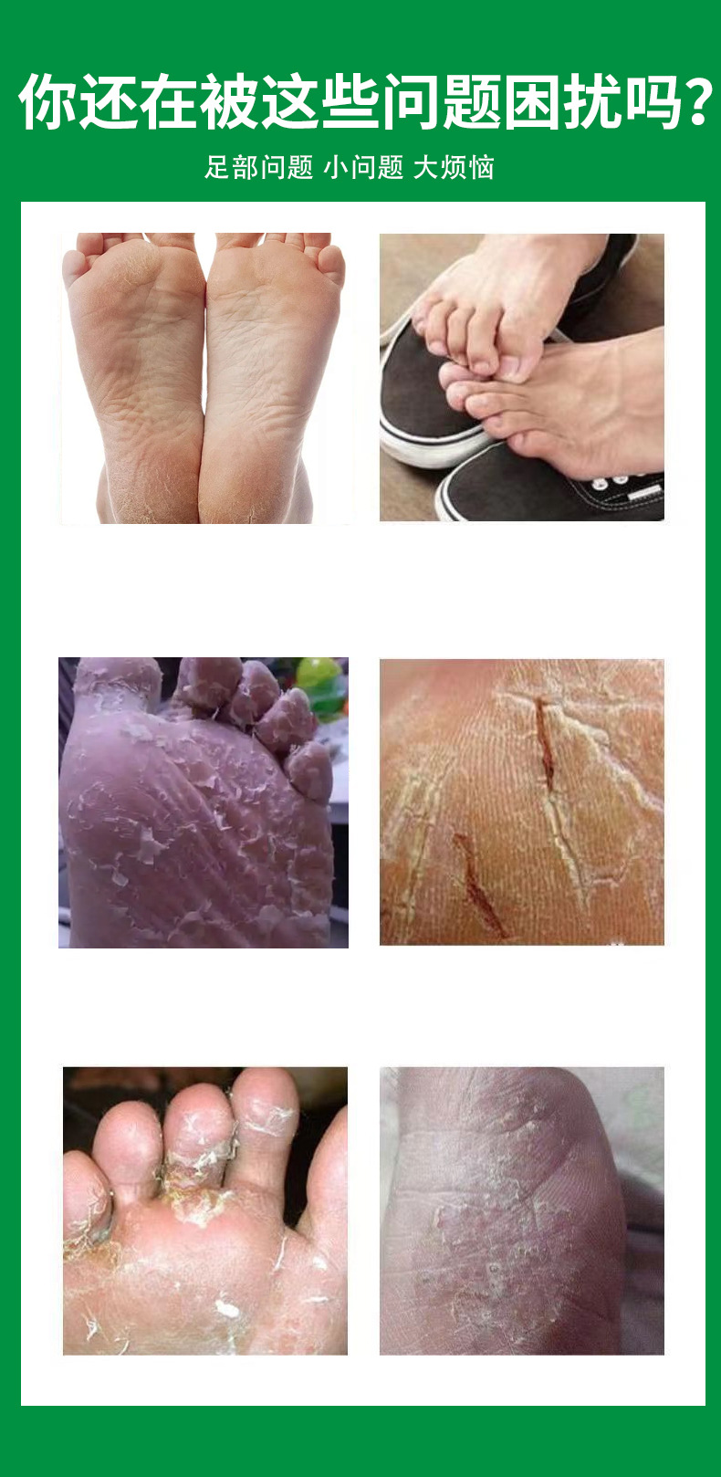 Langdu External Spray for Foot and Leg Care 60ml Herbal Topical quality and texture