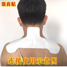 ͨ�ò��ʽ�i��늘OƬ�i׵�粿�����NƬ�е��l����Ќ��w�}ͨ�}�_