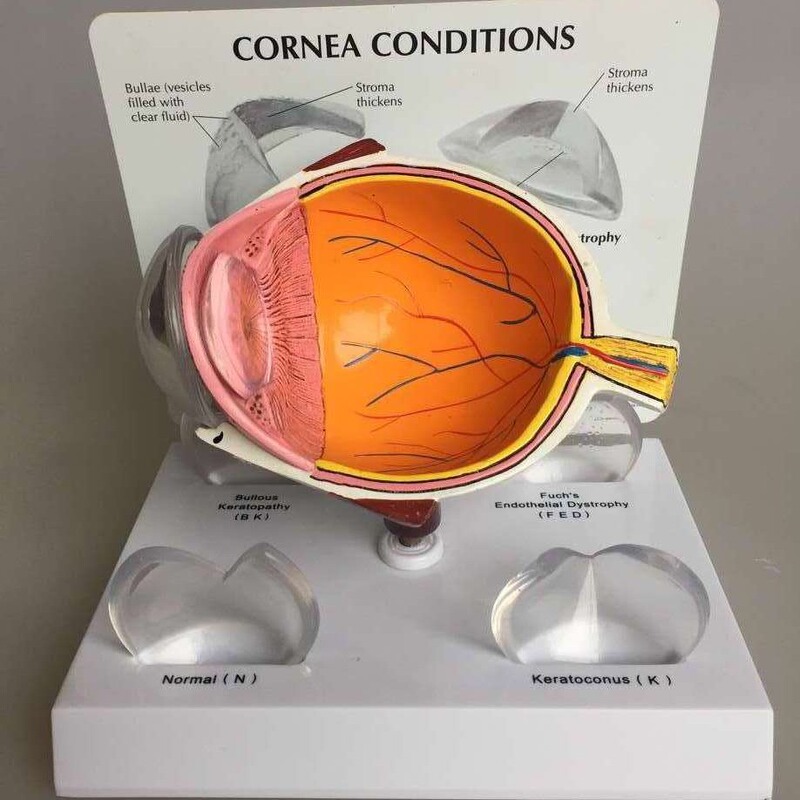 Supply of Eyeball Model Eyeball Lesion Model Corneal Lesion Eyeball Model Medical Teaching Textbook Model Supply of Eyeball Model Eyeball Lesion Model Corneal Lesion Eyeball Model Medical Teaching Textbook Model