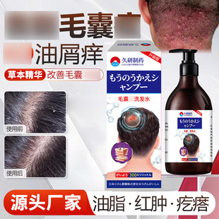 ������ș֬����ϴ�lˮƤ���^Ƥмú����ϴ��ȥм����ֹ�W���Sֱ�I