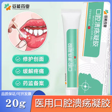 妥能药业口腔溃疡凝胶一点灵医用儿童上火舌头复发性起水泡口疮