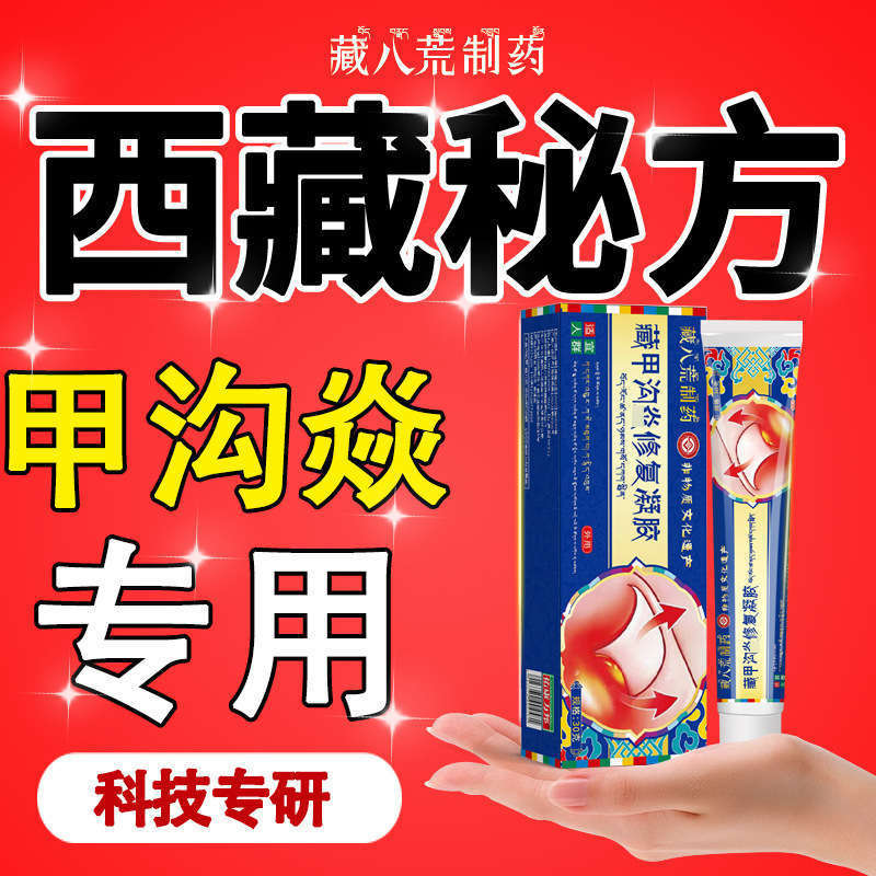 Zangba Huang Pharmaceutical 爪溝特別な鎮静陥入爪除去軟化剤足の爪の長い肉非矯正クリーム|undefined