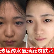 美容院爽肤水大容量大瓶装收缩毛孔玻尿酸深补水保湿提亮细致毛孔