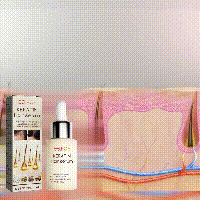 EELHOE Hair Thickness Essence Spendet dem Haar Feuchtigkeit, repariert die Haarwurzeln, verdickt den Haaransatz, kräftigt und stärkt das Haar, Haarpflege-Essenz_voghion.com