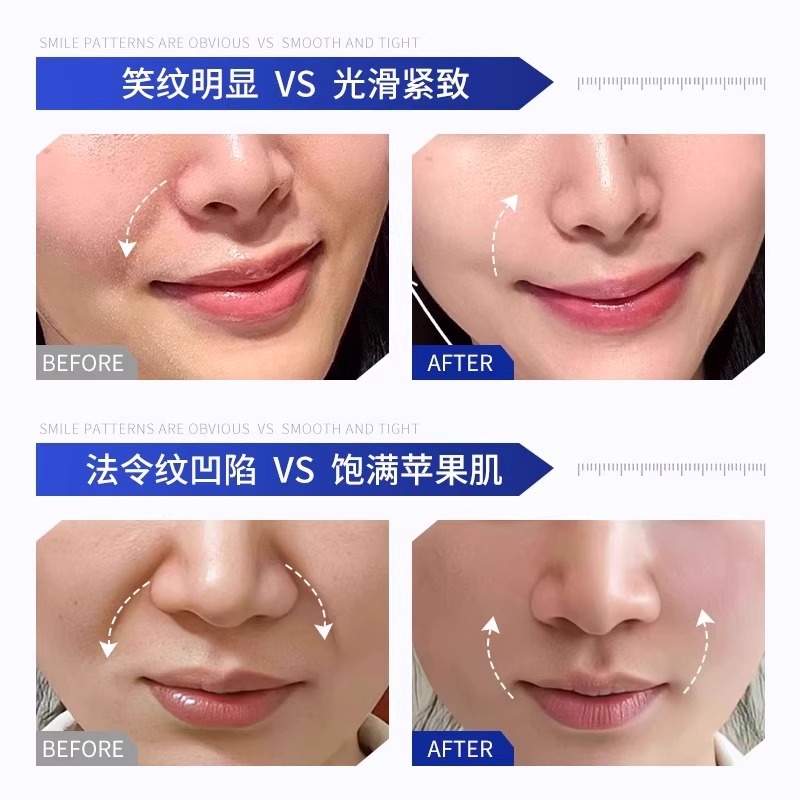 Impresión transfronteriza de ácido hialurónico adhesivo denso humectante suave brillante estiramiento firme antienvejecimiento adhesivo adhesivo image 5