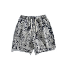 ��Σ˹PEEVIH�����_ѝ���Ƀ�ѝ��Ů�Ӽ�˯ѝ�I��ͨѝ��