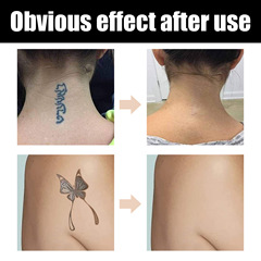 EELHOE Tattoo Concealer Cream Waterproof Brightening Scar Cover Concealer for Tattoos, Birthmarks, Scars, Invisible Dual-Tone Concealer