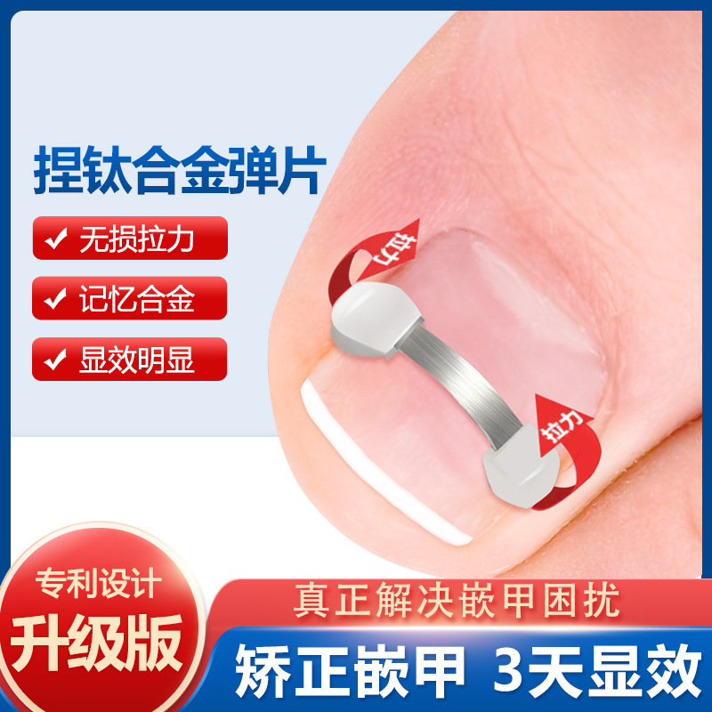 Nail groove ingrown nail nickel titanium alloy bionic bone shrapnel steel wire corrector piece toe nail nail pricking inflammation corrector