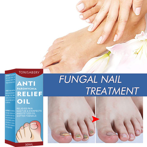 Anti-nail groove relief oil, soft nail polish, nail repair, ingrown toenail thickening, onychomycosis, nail groove care oil
