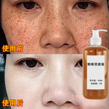 �ܹ���ԭҺ��ɫҺ�������Һ�S�ְ���Ƥ��Ժ���ܰ�Һ���۰׾��AҺ