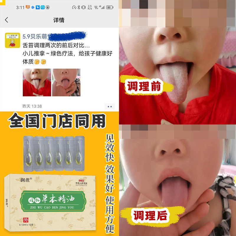 児童臍治療滴剤草本滴剤臍宝精油滴剤小児臍灸粉液咽頭平食脾健下痢|undefined