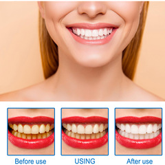 EELHOE Teeth Whitening Essence, Cleaning Stains and Plaque, Improving Yellow Teeth, Stain Removing and Dentifrice for Teeth