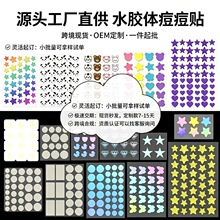 �羳���Ƕ����N��ɫ��ͨˮ�z�w�[�ζ����NԴ�^���S���Q���l���Ø�