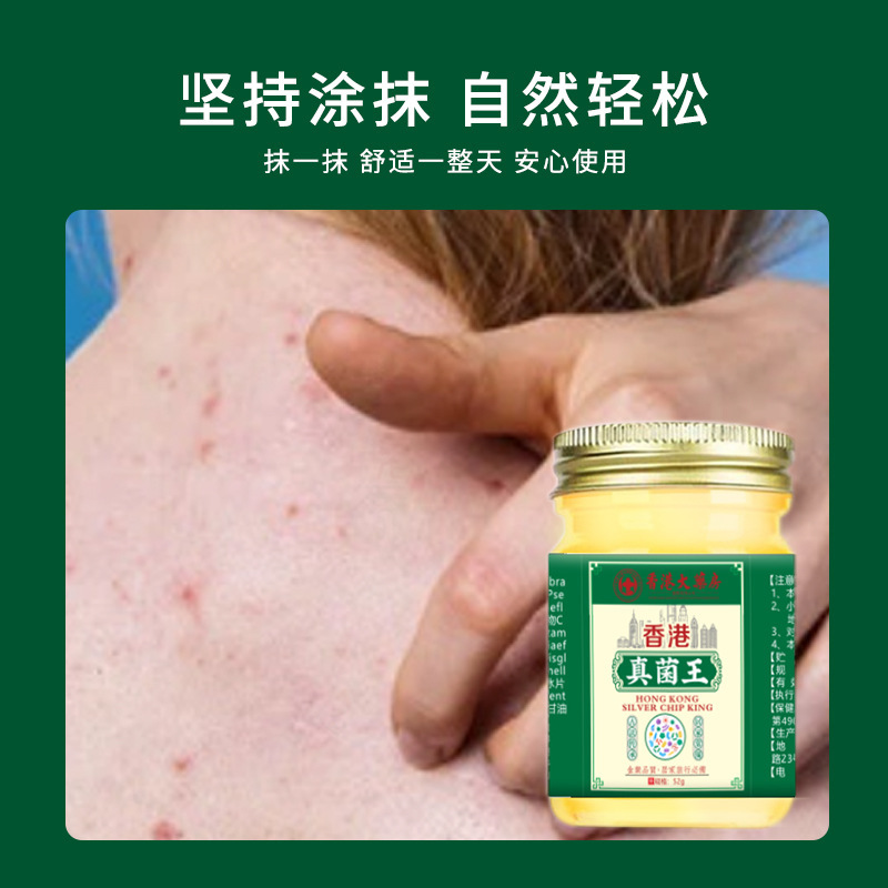 香港大药房真菌王草本乳膏手足起水泡手痒干裂水泡脱皮止痒护理膏|undefined