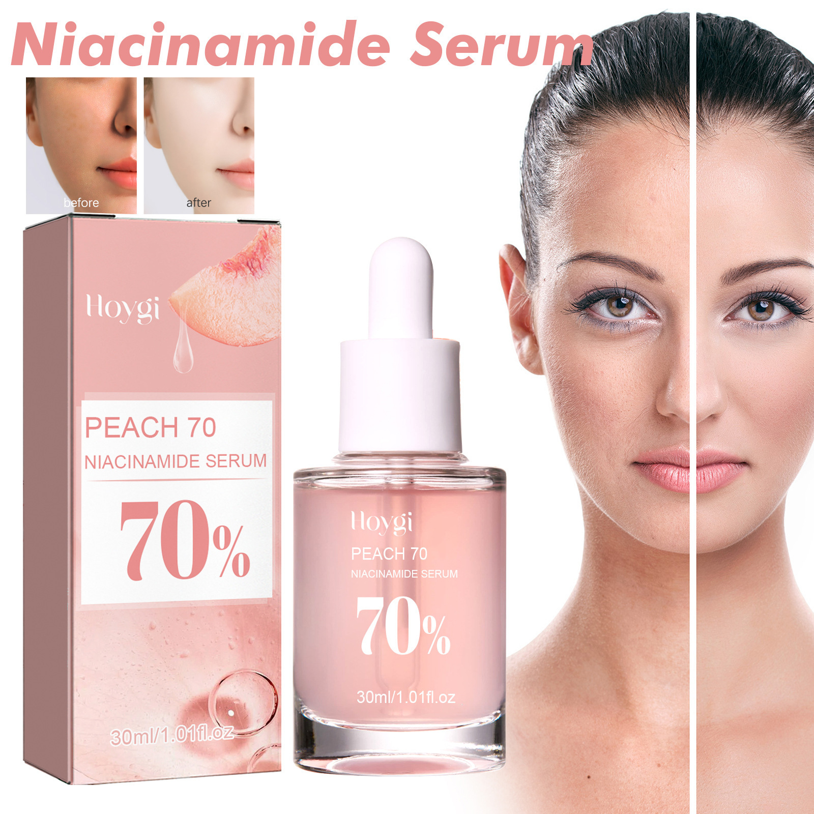 Hoygi Niacinamide Essence Tightens and Moisturizes Pores, Fades Acne Marks, Fine Lines, and Spots, Rejuvenates Skin, Hydrates, and Brightens Skin