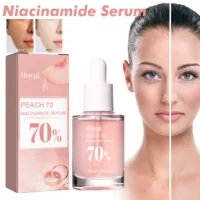 Эссенция Hoygi Niacinamide сужает и увлажняет поры, уменьшает следы акне, тонкие линии и пятна, омолаживает кожу, увлажняет и отбеливает кожу.
