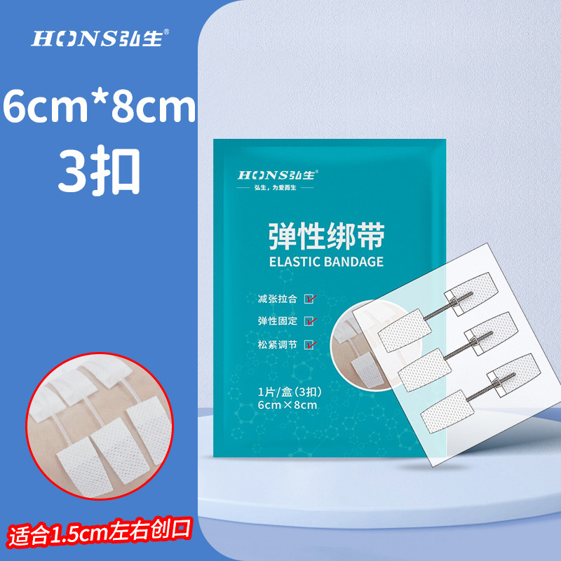 ホンシェン張力緩和器、縫合不要創傷閉鎖器、不織布ジッパー式創傷パッチ、皮膚張力緩和吻合器