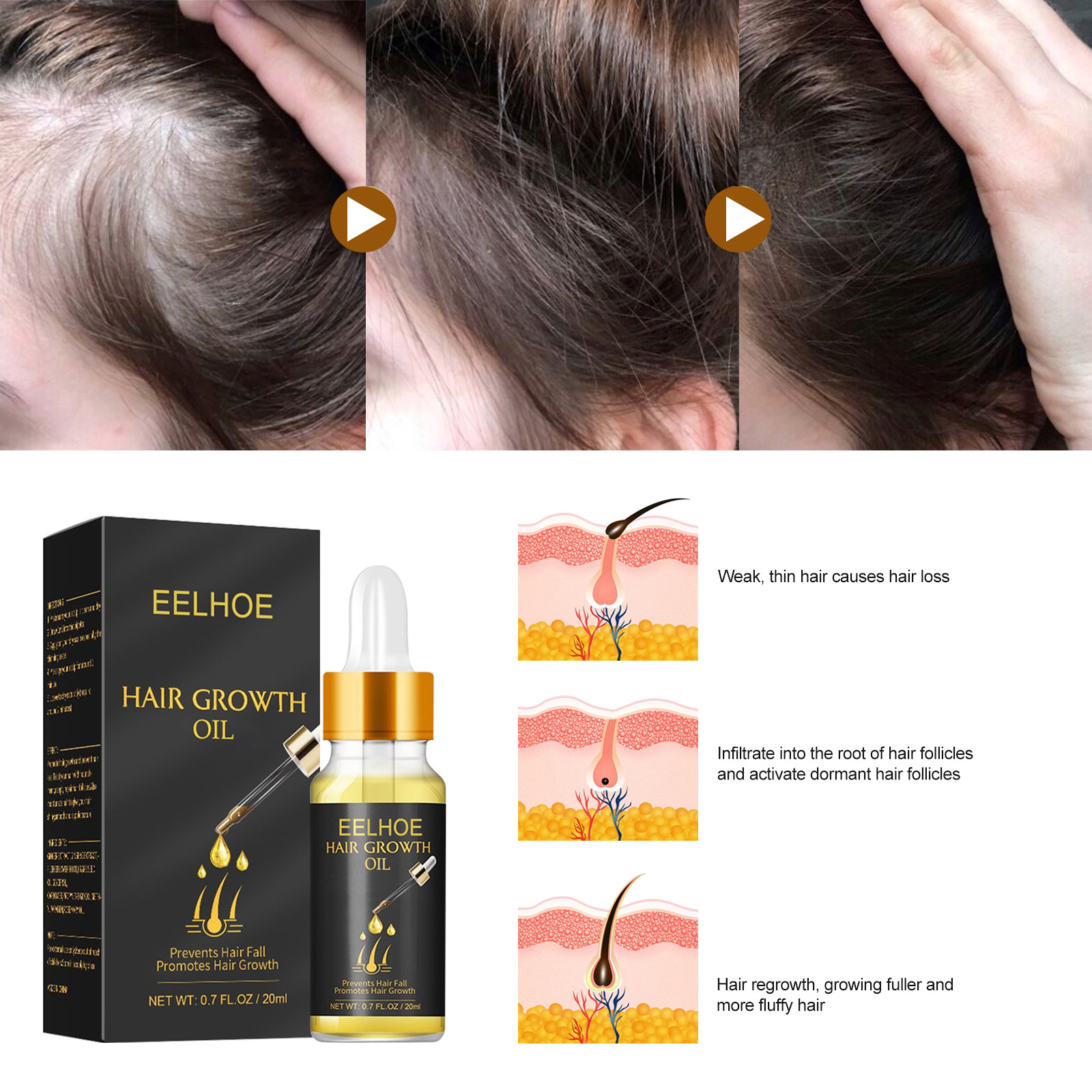EELHOE Dense Firming Strong Tough Hair Care Essence Oil, Soft and Moisturizing Hair, Thick_voghion.com