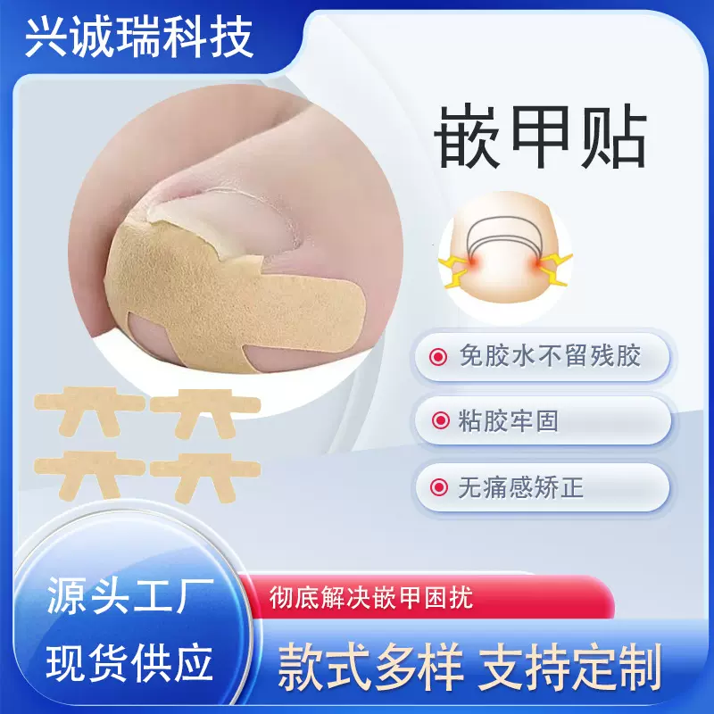 现货正甲贴甲沟嵌甲矫正免胶水正甲贴片脚趾变形指甲固定美甲硬甲