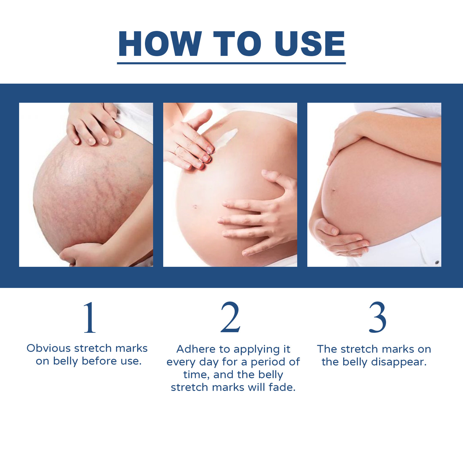 EELHOE Impacco freddo Bruciore Attenuante Riparazione chirurgica Levigante Crema gel per cicatrici cutanee_voghion.com