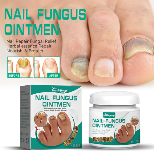 South Moon Onychomycosis Cream Thickened Bright Nail Onychomycosis Repair Soft Nail Cream for Hand, Foot, and Toenail Care