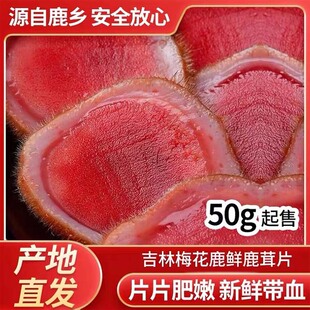 �r¹��Ƭ�����pꖖ|���خa¹�l��֧��Ѫ¹����Ƭ¹��ֱ���F؛���l