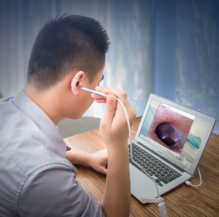 3,9 мм визуальный отоскоп Android 3 в 1 визуальный эндоскоп уха 3,9 мм ухо нос полости рта USB микроскоп