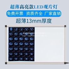 ��Ƭ�˴�x�^Ƭ�ǿ�ledCT���������Ƭ�Ƭ���������^Ƭ�ǿ�