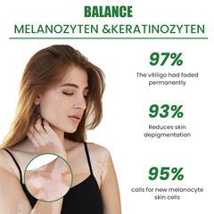 EELHOE 白斑修護霜 皮膚花斑白斑黑色素修護均勻膚色外用護理霜