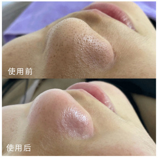 Pore cleaning cream facial massage cream blackhead removing acne shrink pores deep cleansing cutin beauty salon special