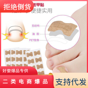Glue-free Lala Correction Paste Nail Paste Toenail Inlay Nail Corrector Toenail Long Meat Improving Nail Groove