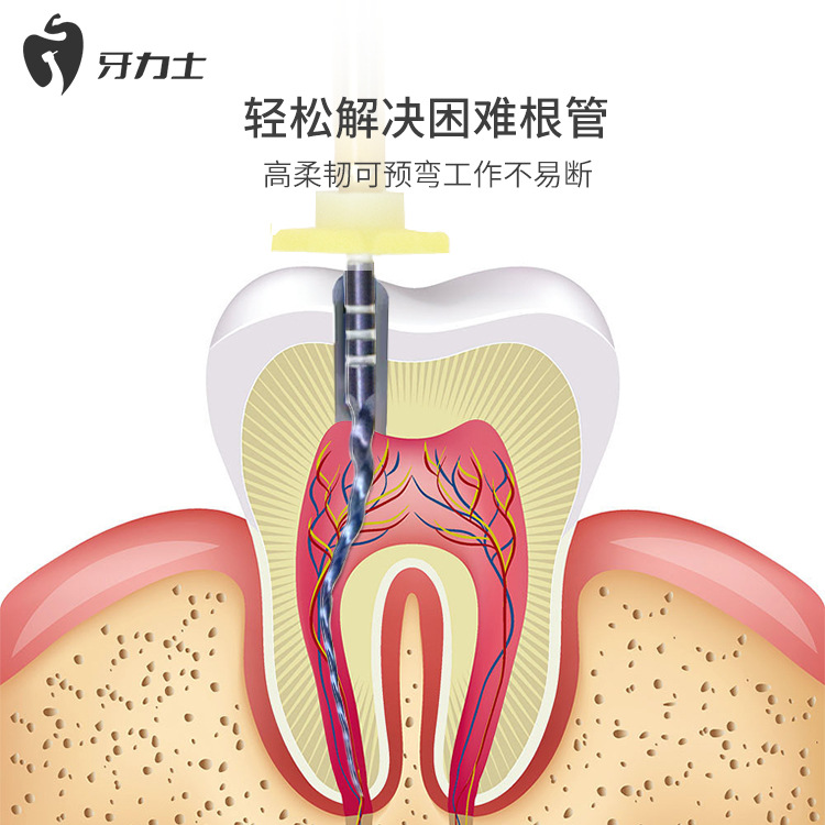 Limas para Endodoncia, Limas Mecánicas de Níquel-Titanio, Agujas de Ampliación Activadas por Calor, Consumibles Orales, Limas para Tratamiento de Conducto Radicular.