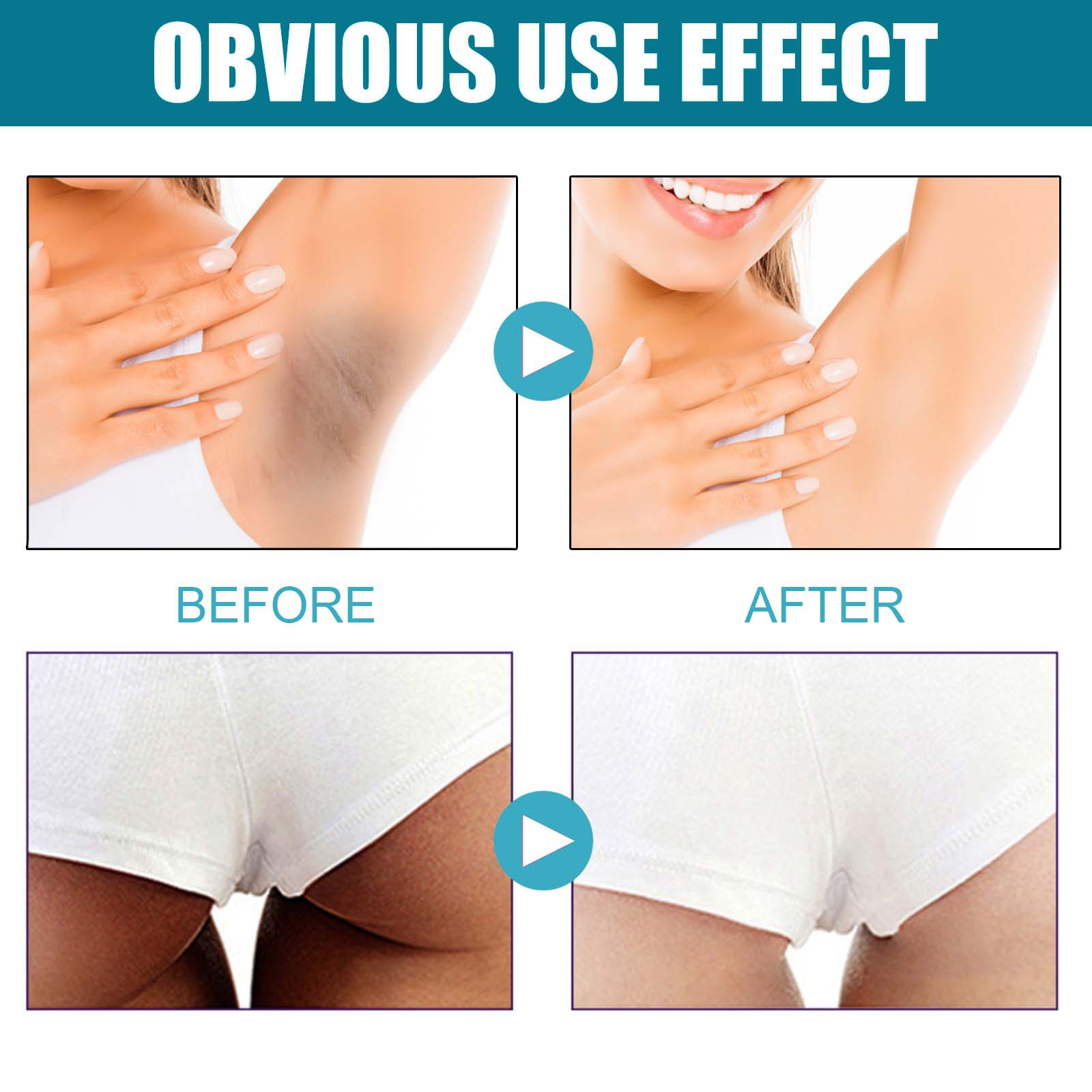 West&Month Exfoliating Pad renser i dybden død hud i kroppen, falmer ledsorthed, blødgør oplyser huden,_voghion.com