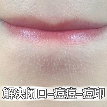 �۲����ҽ�Q���^�]�ڶ���ӡ��ë�׾��ǡ��տsë�׾��AҺ���o�ִ�